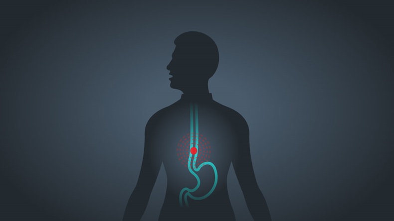 Esophageal Cancer vector 